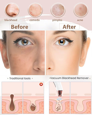 Pore Glow
